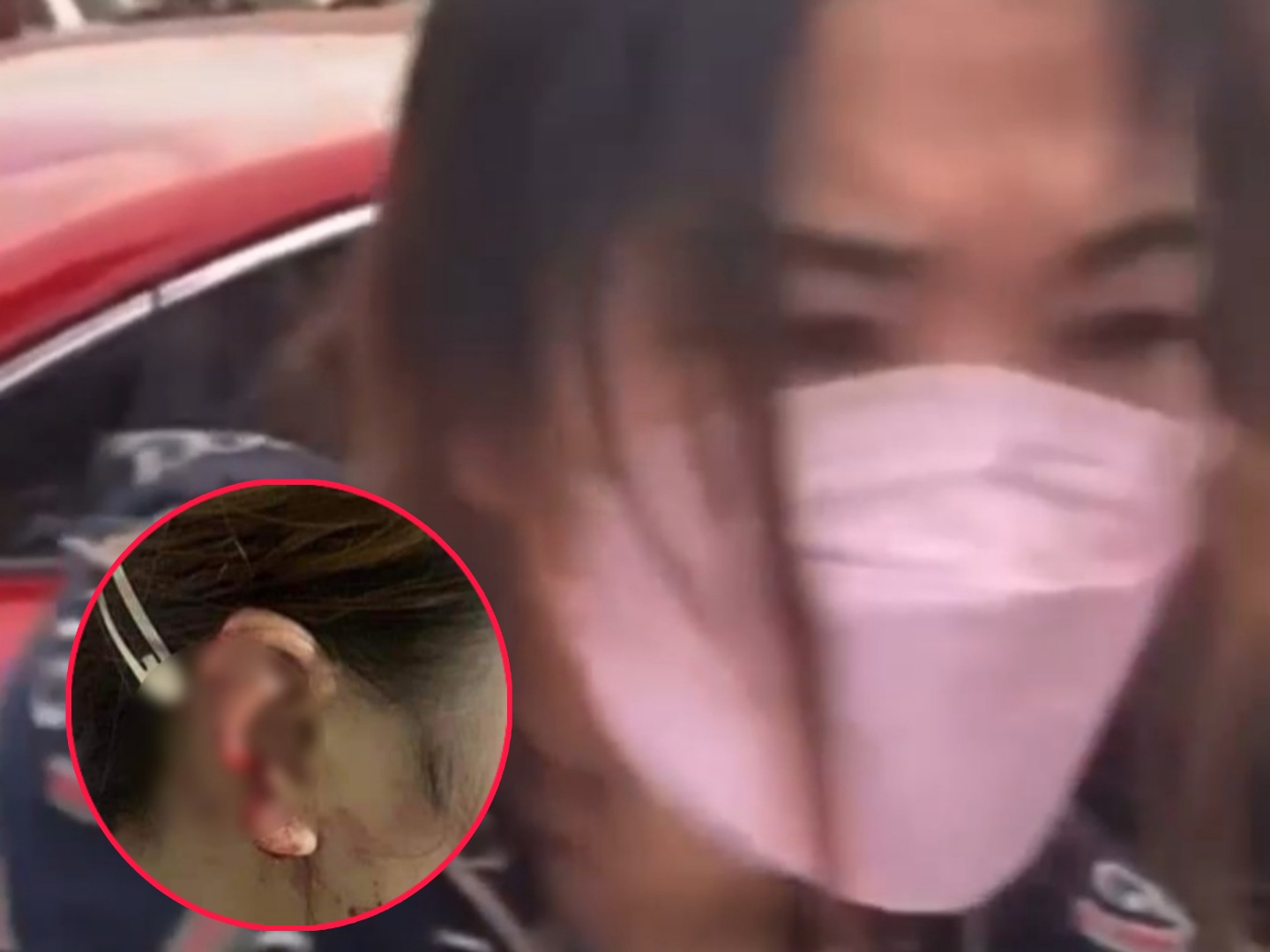 Người phụ nữ đi đ&aacute;nh ghen bị khởi tố v&igrave; tội Cố &yacute; g&acirc;y thương t&iacute;ch.